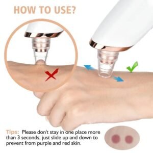 Remove Impurities Black Head Remover