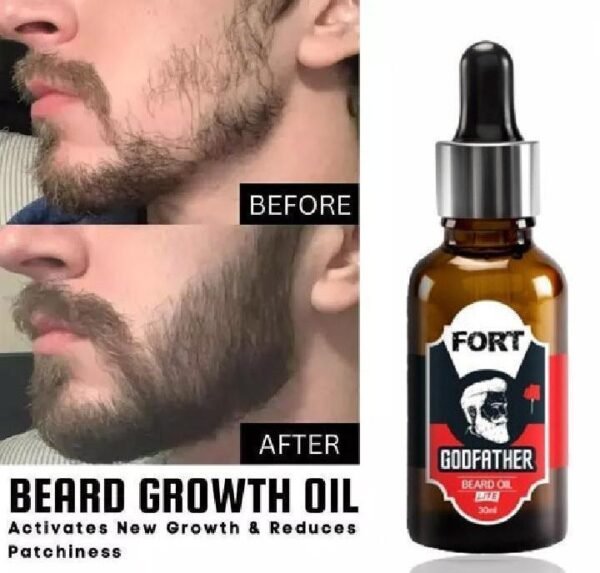 Nourishing Beard Oil for Damaged Hair - 1 x Beard Oil - Image 2
